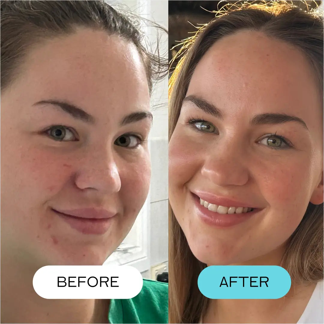 Super Collagen Moisture Dew