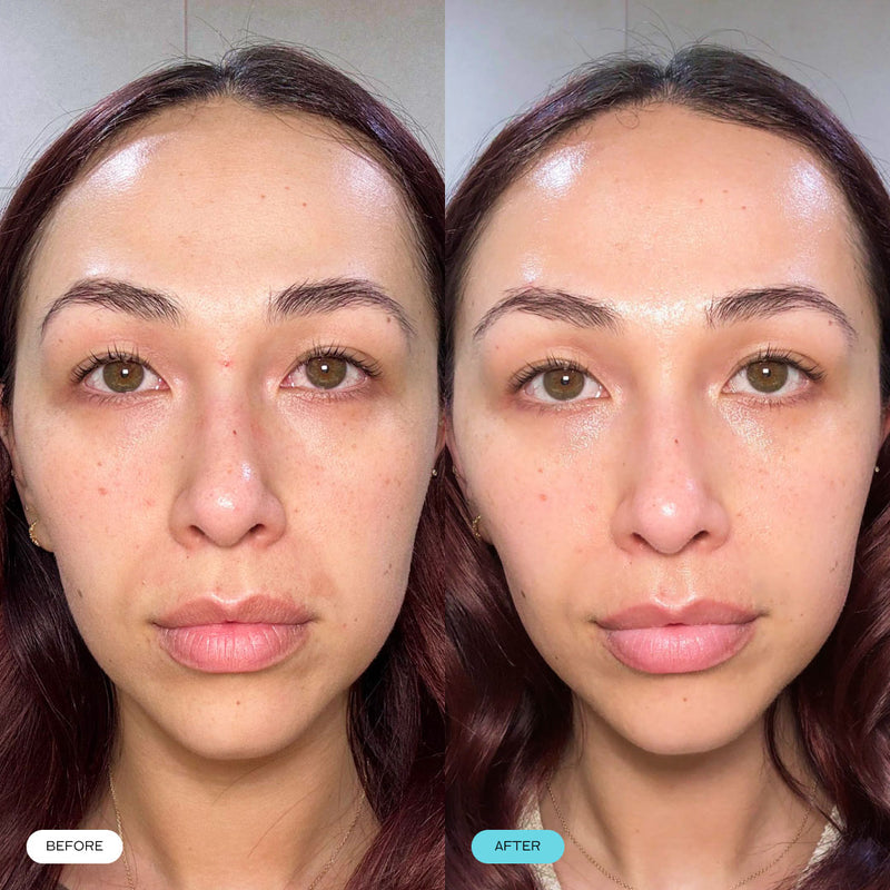 Before and After Essence